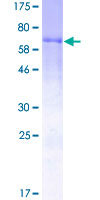 Recombinant Human Factor VII protein