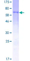 SDS-PAGE - Recombinant Human Factor VII protein (GST tag N-Terminus) (AB158401)