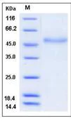 SDS-PAGE - Recombinant Human Factor VII protein (His tag) (AB276398)