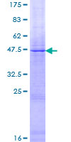 SDS-PAGE - Recombinant Human Factor VIII protein (AB158403)