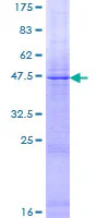 SDS-PAGE - Recombinant Human Factor VIII protein (GST tag N-Terminus) (AB158403)