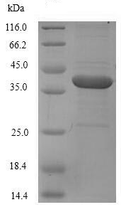SDS-PAGE - Recombinant Human Factor XIa protein (His tag) (AB235675)