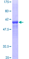 SDS-PAGE - Recombinant Human Factor XII protein (GST tag N-Terminus) (AB158410)
