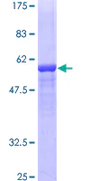 SDS-PAGE - Recombinant Human Factor XII protein (GST tag N-Terminus) (AB158410)