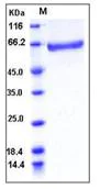 SDS-PAGE - Recombinant Human Factor XIII protein (His tag) (AB276399)