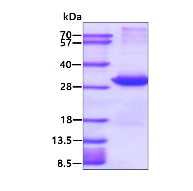 SDS-PAGE - Recombinant Human FADD protein (AB89242), expandable thumbnail