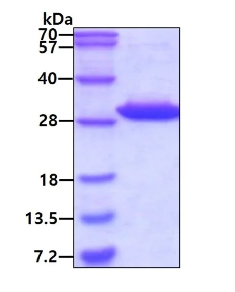 SDS-PAGE - Recombinant Human FAHD1/Oxaloacetate decarboxylase protein (AB104015)