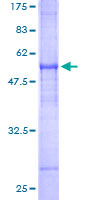 SDS-PAGE - Recombinant Human FAIM2/LFG protein (AB161504), expandable thumbnail