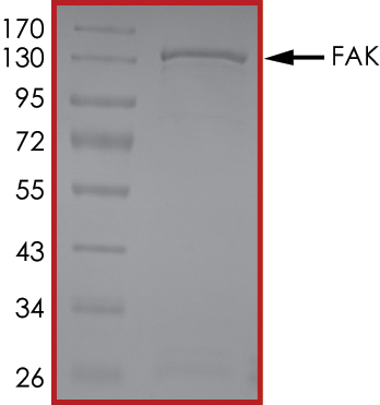 SDS-PAGE - Recombinant human FAK protein (AB105909), expandable thumbnail