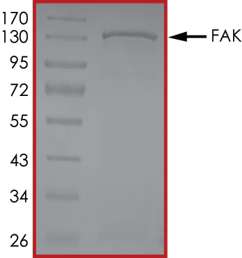 SDS-PAGE - Recombinant human FAK protein (AB105909)