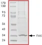 SDS-PAGE - Recombinant human FAK protein (His tag N-Terminus) (AB60852)