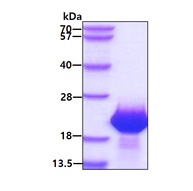 SDS-PAGE - Recombinant Human FAM107B protein (AB171700), expandable thumbnail