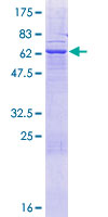 SDS-PAGE - Recombinant Human FAM108A1 protein (AB164382)