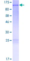 SDS-PAGE - Recombinant Human FAM13C1 protein (AB165954)