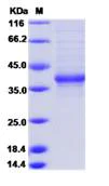 SDS-PAGE - Recombinant Human FAM150A protein (Fc Chimera) (AB276667)