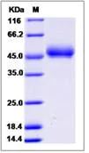 SDS-PAGE - Recombinant Human FAM171B protein (His tag) (AB276584)