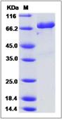 SDS-PAGE - Recombinant Human FAM20B protein (Fc Chimera) (AB276659)