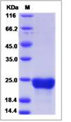 SDS-PAGE - Recombinant Human FAM3C/ILEI protein (His tag) (AB276676)