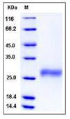 SDS-PAGE - Recombinant Human FAM3D protein (His tag) (AB276419), expandable thumbnail