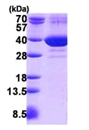 SDS-PAGE - Recombinant Human FAM49B protein (His tag N-Terminus) (AB140726)