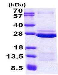 Recombinant Human FAM50A/XAP5 protein