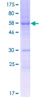 SDS-PAGE - Recombinant Human FAM64A protein (AB162752)