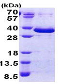 SDS-PAGE - Recombinant Human FAM84A protein (His tag N-Terminus) (AB167861)