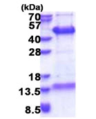 SDS-PAGE - Recombinant Human FAM84B protein (His tag N-Terminus) (AB174398)