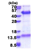 SDS-PAGE - Recombinant Human FAM84B protein (His tag N-Terminus) (AB174398)