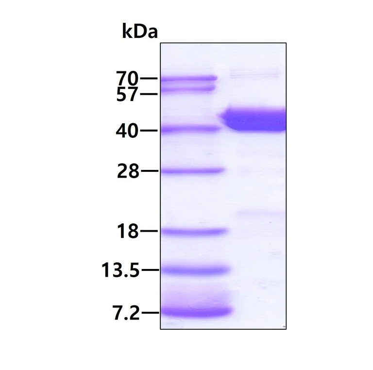 SDS-PAGE - Recombinant Human FANK1 protein (AB176049)