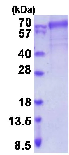 SDS-PAGE - Recombinant Human FARSLB protein (denatured) (His tag N-Terminus) (AB202202)