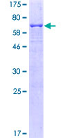 SDS-PAGE - Recombinant Human Fas protein (AB131871), expandable thumbnail