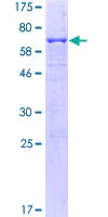 SDS-PAGE - Recombinant Human Fas protein (AB131871)