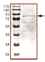 SDS-PAGE - Recombinant human FASTK protein (AB131693)
