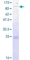 Recombinant Human FATP1 protein