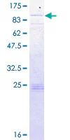 SDS-PAGE - Recombinant Human FATP1 protein (AB132799)