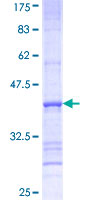 SDS-PAGE - Recombinant Human FATP3 protein (AB161234), expandable thumbnail