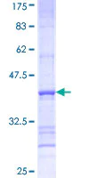 SDS-PAGE - Recombinant Human FATP3 protein (AB161234)