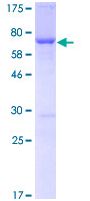 Recombinant Human Fatty Acid Synthase protein