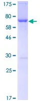 SDS-PAGE - Recombinant Human Fatty Acid Synthase protein (GST tag N-Terminus) (AB131929)