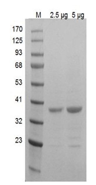 SDS-PAGE - Recombinant human FBP1 protein (Active) (AB286057)