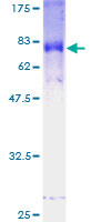 Recombinant Human FBXL2 protein