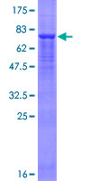 SDS-PAGE - Recombinant Human FBXO9 protein (AB161954), expandable thumbnail