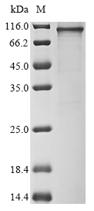 SDS-PAGE - Recombinant Human Fbxw7 protein (AB289752), expandable thumbnail