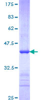 SDS-PAGE - Recombinant Human Fbxw7 protein (GST tag N-Terminus) (AB163053)