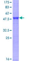 SDS-PAGE - Recombinant Human Fc epsilon RI/FCER1A protein (GST tag N-Terminus) (AB114334)