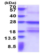 SDS-PAGE - Recombinant Human Fc epsilon RI/FCER1A protein (His tag N-Terminus) (AB171505)