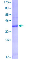 SDS-PAGE - Recombinant Human FCGRT/FCRN protein (GST tag N-Terminus) (AB152382)