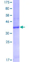 SDS-PAGE - Recombinant Human FCGRT/FCRN protein (GST tag N-Terminus) (AB152382)