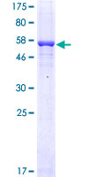 Recombinant Human FCN1/M-Ficolin protein